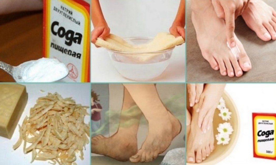 Убрать запах ног в домашних условиях быстро. Народные средства от потливости ног. Народные средства от потливых ног. Народные средства от запаха ног. Метод избавления от запаха ног.