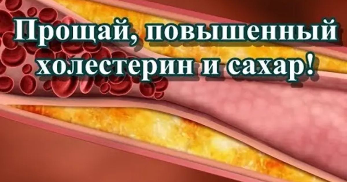 Повышенный холестерин и глюкоза