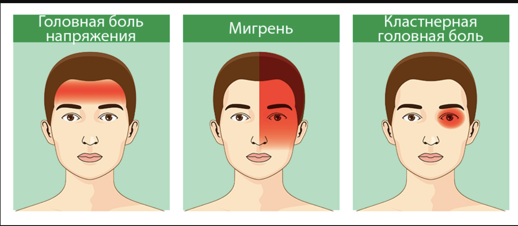 Холодный лоб. Кластерная головная боль. Постоянные головные боли причины. Головная боль напряжения.