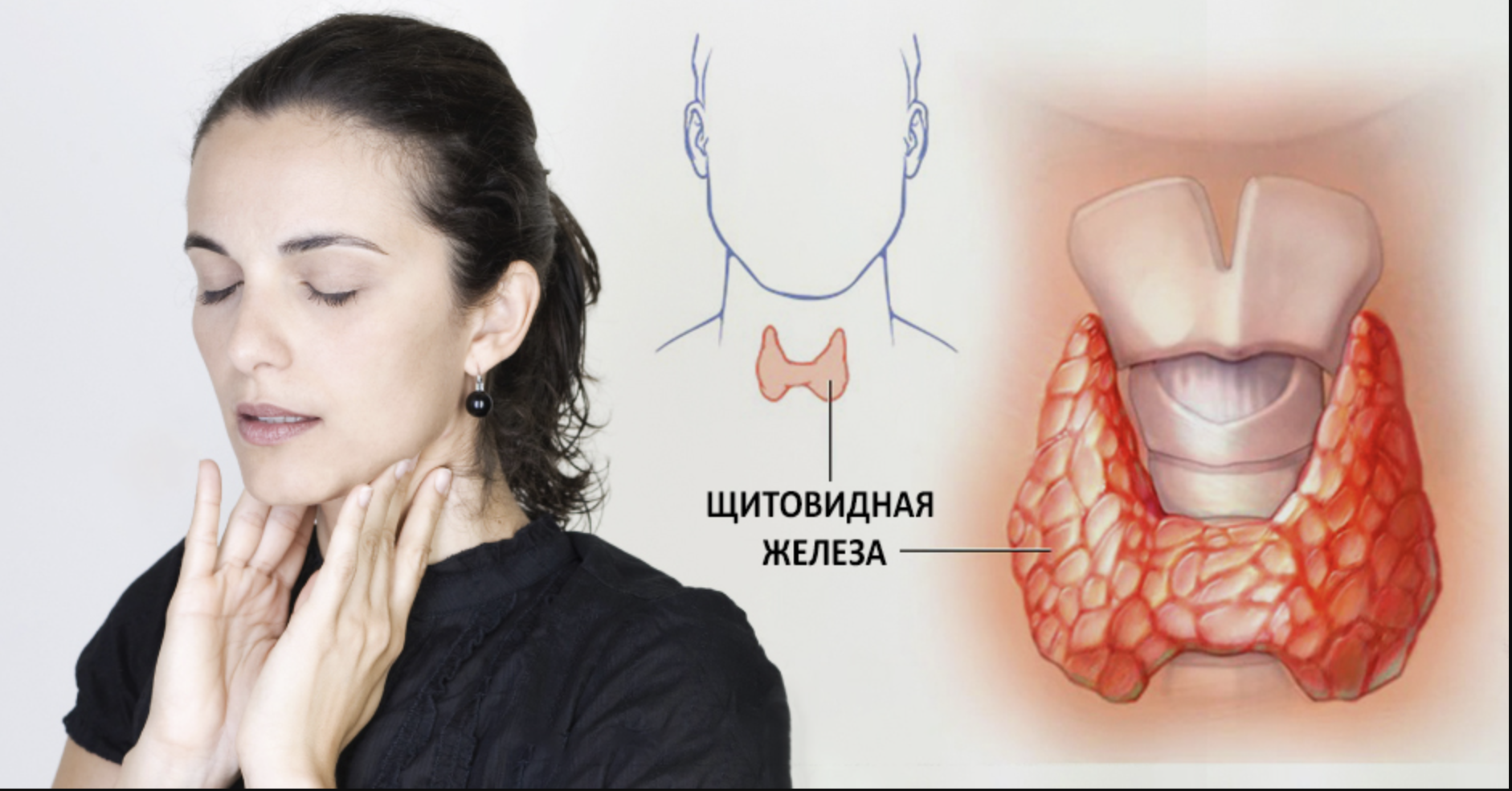 Заболевания щитовидной железы. Нарушение щитовидной железы. Как жить без щитовидной железы