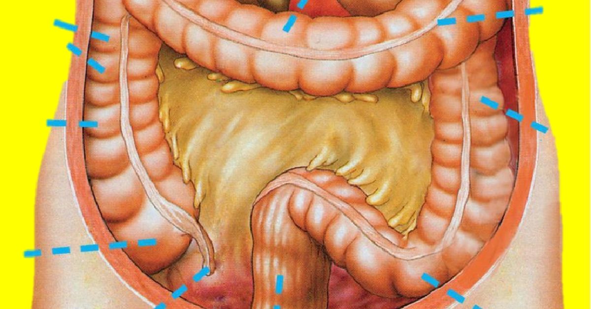 Отделы прямой кишки. Ректосигмоидный отдел толстой кишки. Ректосигмоидный отдел толстой кишки анатомия. Прямая кишка ректосигмоидный отдел. Ректосигмоидный отдел ободочной кишки.