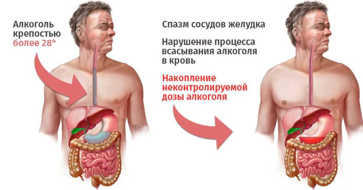 Влияние на жкт. Алкоголь и желудочно кишечный тракт. Влияние алкоголя на желудочно-кишечный тракт.