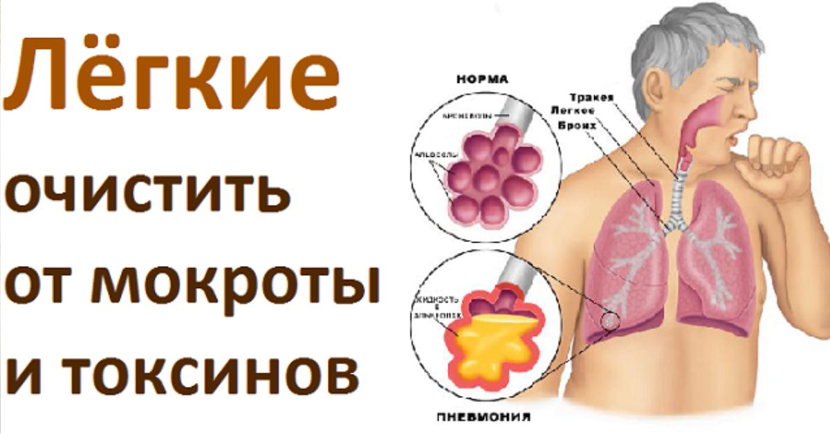 Легко выводимый. Очистка бронхов и легких от мокроты. Очистить лёгкие от макроты. Препараты для очистки бронхов от слизи.