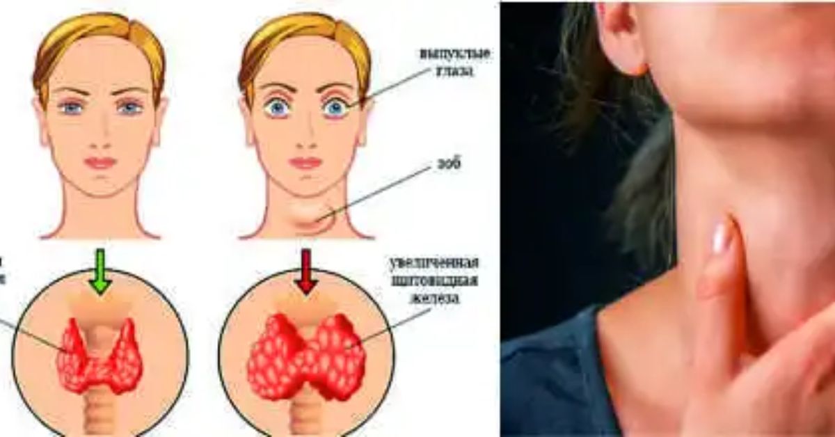Щитовидка где находится схема у женщины фото показ