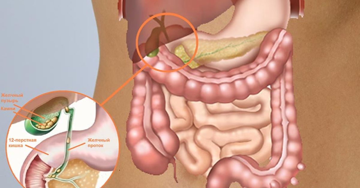 Кишечка это. Желчный пузырь и кишечник. Переполненный кишечник. Желчный расположение.