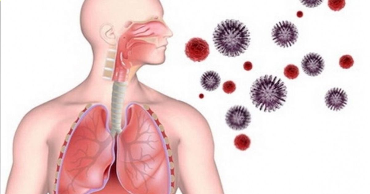 Нижний поражение. Воздушно - капельные инфекции (инфекции дыхательных путей). Воздушно капельный путь передачи краснухи. Заболевания дыхательной системы пневмония бронхит. Пневмония и заболевание верхних дыхательных путей.