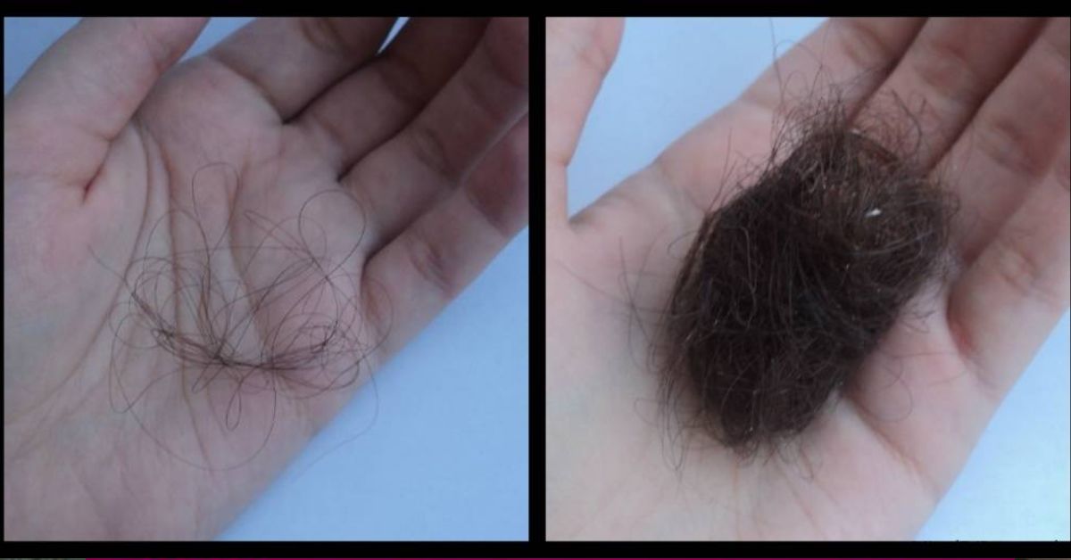 Почему выпадают волосы после мытья. Норма выпадения волос. Норма выпаданий волос в день. Еорма выпадений волос в день. Норма выпадения волос в день.