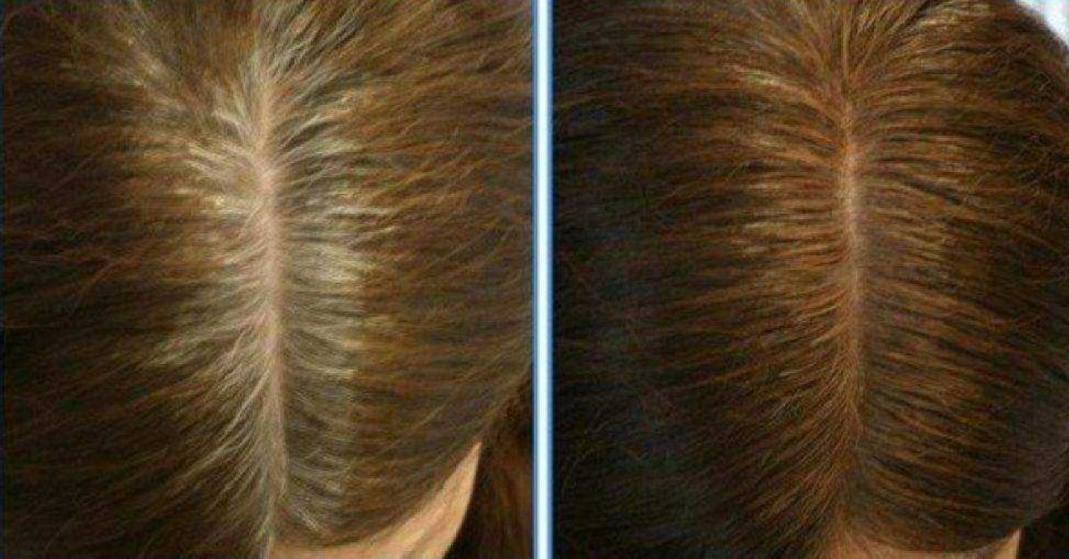 Закрасить седину в домашних условиях без краски. Окрашивание седых волос до и после. Окрашивание волос избавление от седых волос. Мезотерапия от седых волос. Мезотерапия для волос от седины.