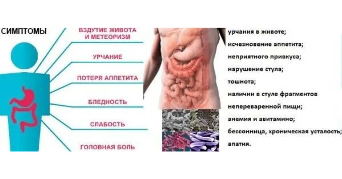 Колики в кишечнике. Кишечная колика симптомы у детей. Колики в кишечнике у взрослых симптомы. Симптомы при кишечной колике. Кишечная колика симптомы у женщин боли.