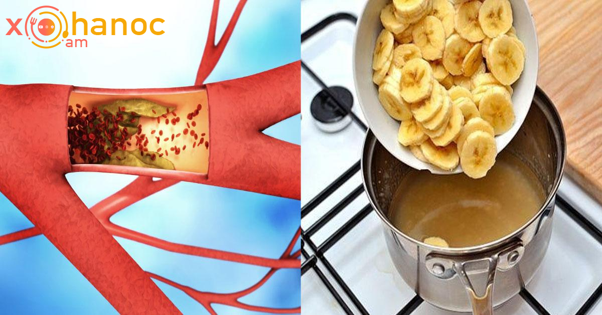 Շնորհիվ այս միջոցի ՝ շաքարի և խոլեստերինի մակարդակը կվերադառնա նորմալ մակարդակի