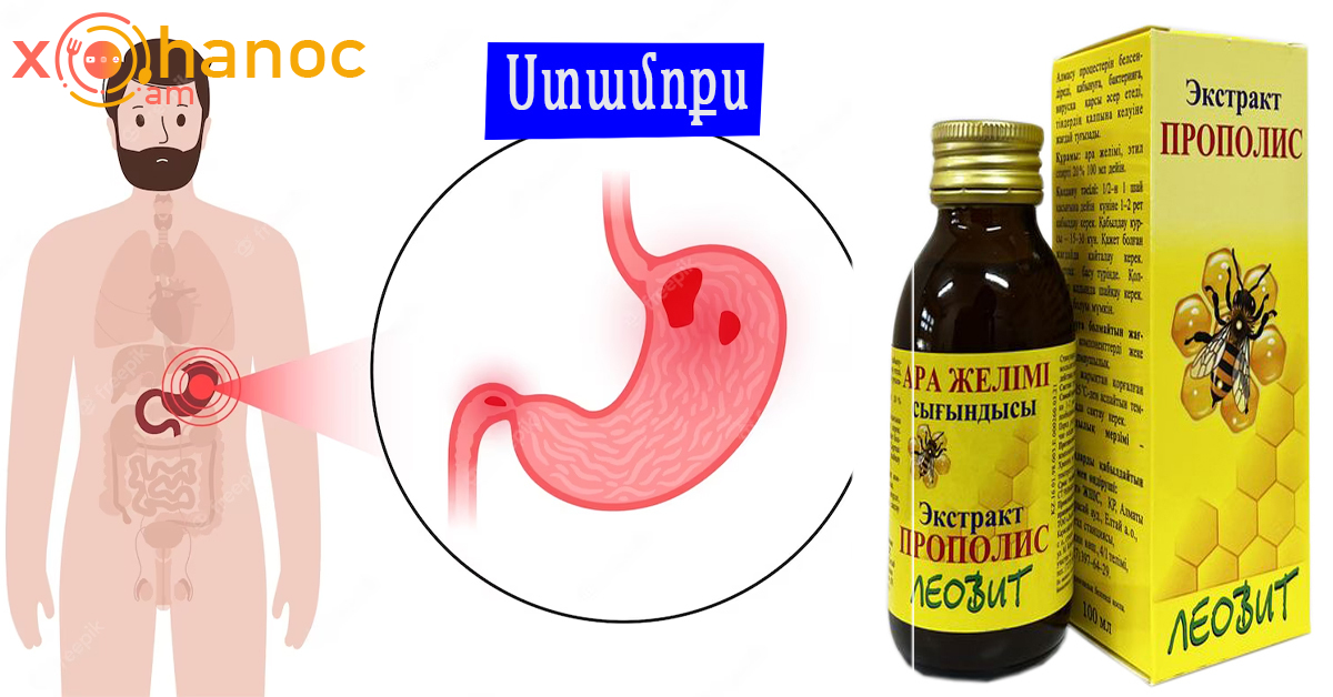 Հզոր միջոց սպանում է բակտերիաները, որոնք առաջացնում են ստամոքսի քաղցկեղ, խոց, գաստրիտ, փքվածություն, ալերգիա և այլն