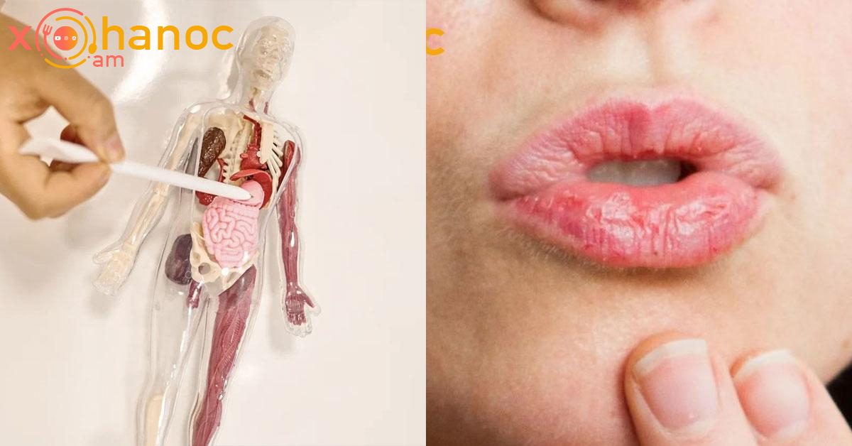 Շուրթեի ճաքելը և լեզվի վրայի սպիտակ ծածկույթը վկայում է այս հիվանդության մասին