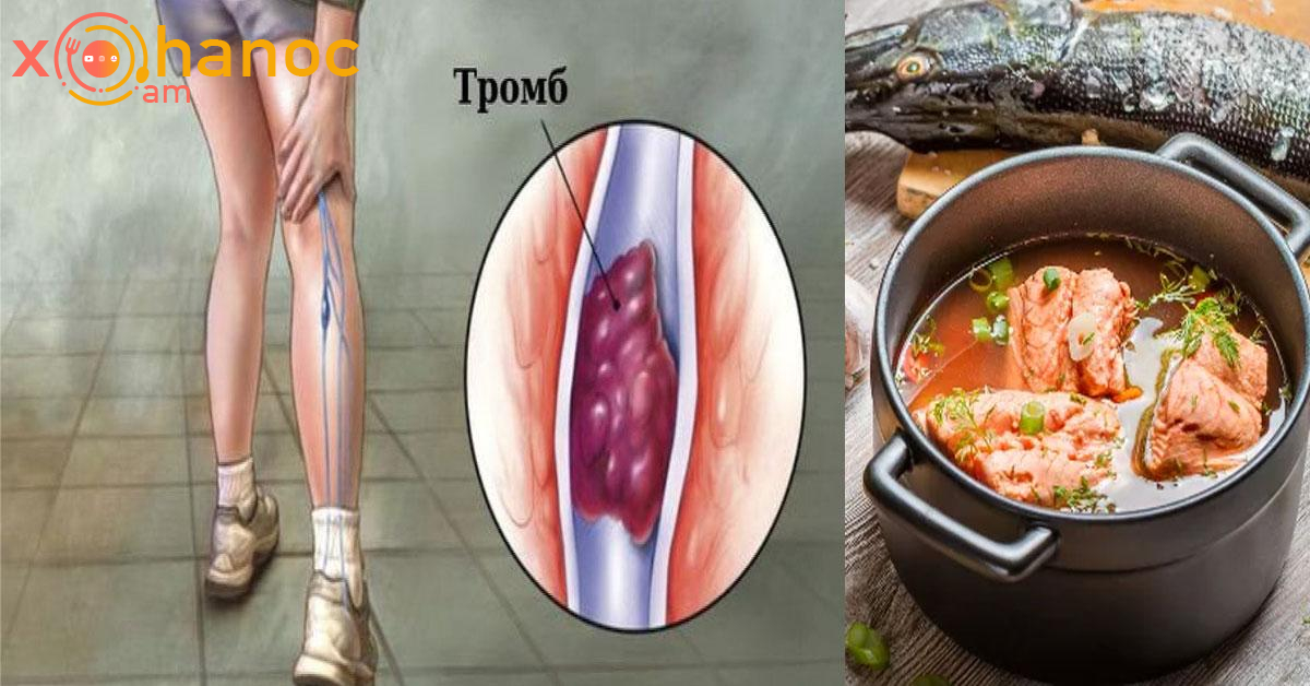 Մթերքներ, որոնք նվազեցնում են թրոմբների առաջացման վտանգը
