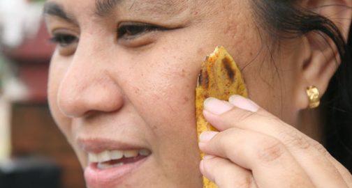 Այս աղջիկը բանանի կեղևը դրեց դեմքին ու որոշ ժամանակ չլվացվեց. արդյունքն ապշեցուցիչ է