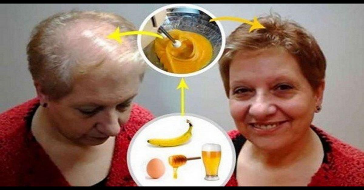 Վերադարձրեք կորցրած մազերը․ Այս միջոցը շատերին է օգնել