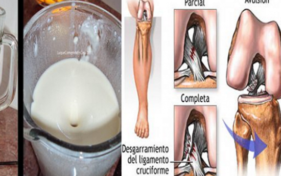 Բնական միջոց ոսկորների ցավի դեմ