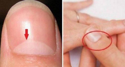 Ահա, թե ինչ է նշանակում եղունգի վրայի կիսալուսինը