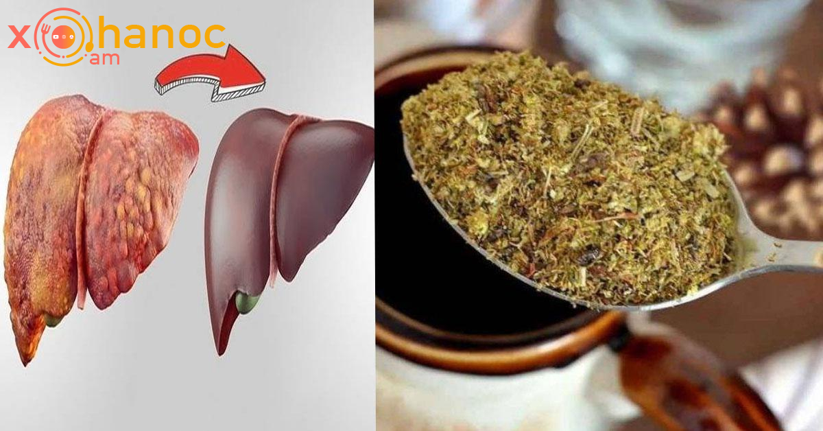 Սա բնական դեղ է լյարդի համար․ Բուժում է ծանր վիճակում գտնվող լյարդը ՝ մաքրելով ճարպն ու լյարդի հիվանդությունները