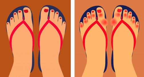 Երբ իմանանք այս մասին, Էժան ռետինե բոկոտիկները երբեք չեք գնի