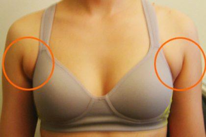 Ինչպես ազատվել թևատակերի ճարպից. արդյունավետ միջոց