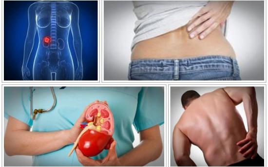 Ինչպե՞ս լավացնել երիկամների աշխատանքը միայն մեկ բաղադրիչով