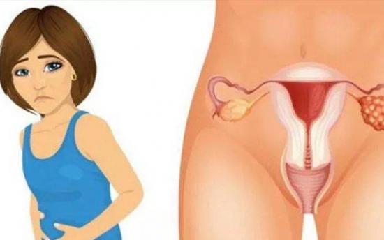 Ձվարանների քաղցկեղի 4 վաղ նշան, որոնց մասին պետք է իմանա յուրաքանչյուր կին