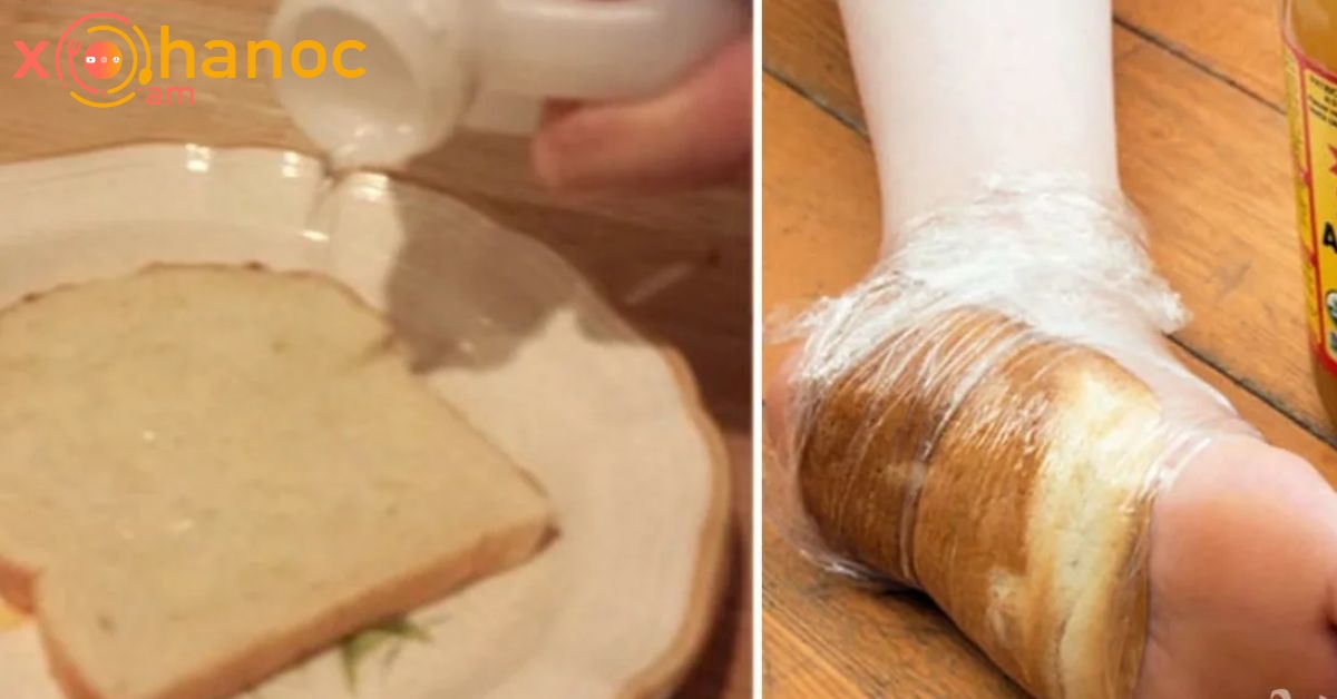Ահա թե ինչ է պատահում, երբ մի կտոր հաց եք փաթաթում ոտքիդ շուրջը