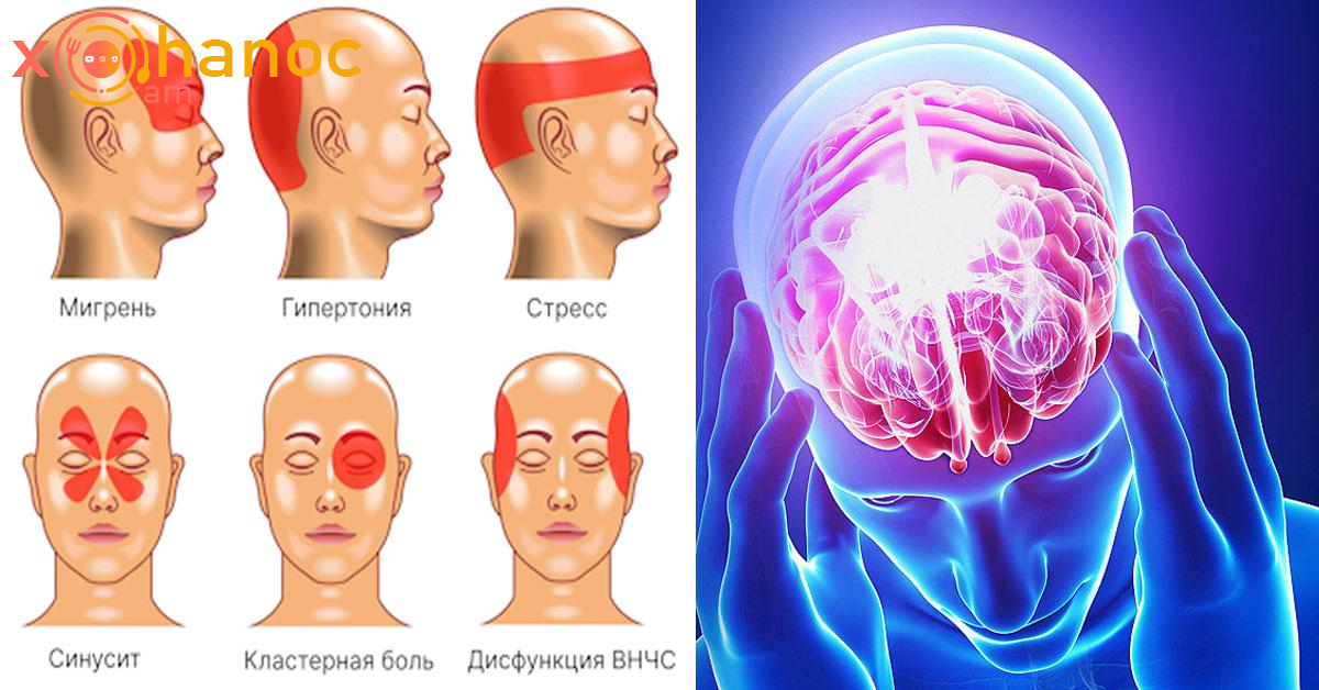 Ցավ գլխի տարբեր հատվածներում. Տեսեք դա ինչ է դա նշանակում