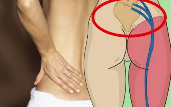 Նստատեղի նյարդի բորբոքմանը հրաժեշտ տվեք ընդամենը 10 րոպեում այս բնական միջոցով