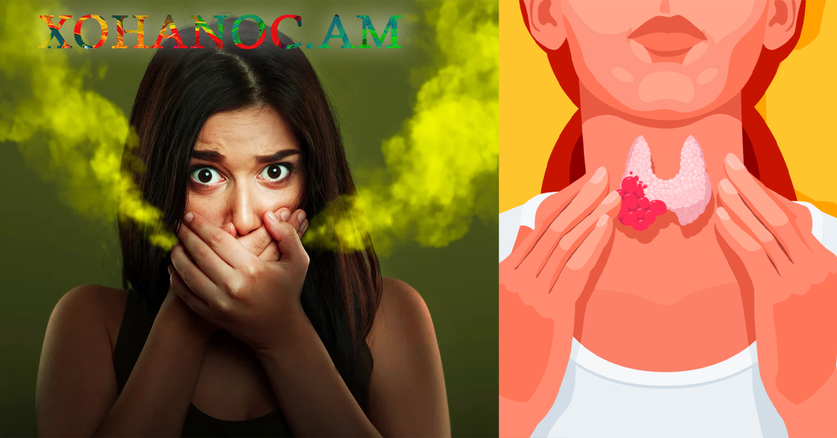 Ի՞նչ հիվանդության նշան է, երբ բերանից տհաճ «ացետոնի» հոտ է գալիս