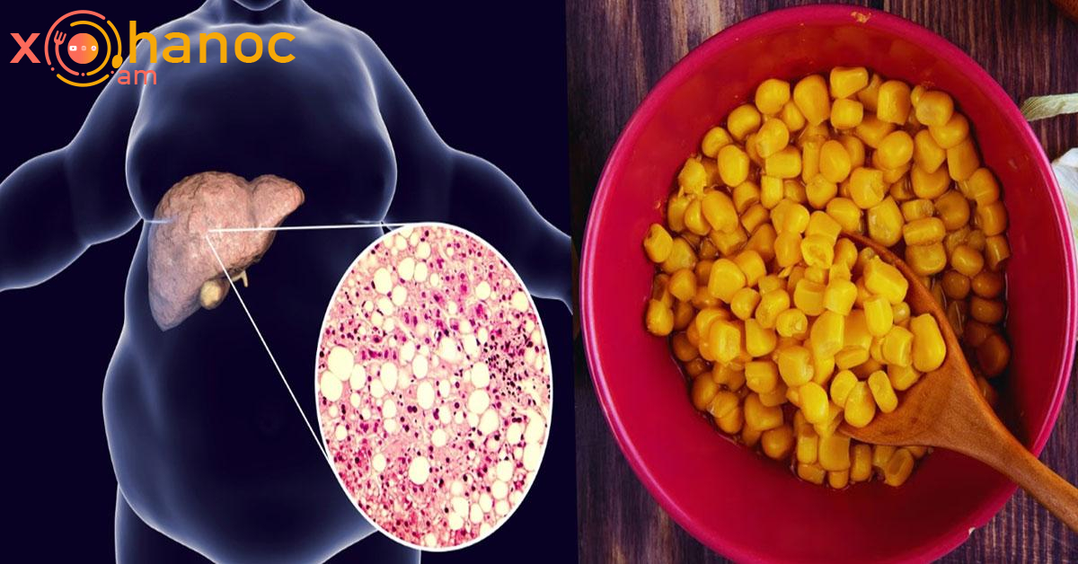 Այս մթերքը դեղ է ճարպակալած լյարդի համար․ Այն մաքրում է լյարդը, բուժում ու կարգավորում լյարդի աշխատանքը Այս մթերքը դեղ է ճարպակալած լյարդի համար․ Այն մաքրում է լյարդը, բուժում ու կարգավորում լյարդի աշխատանքը