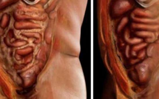 Ինչպես ազատվել օրգանիզմի պարազիտներից