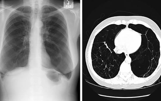 Մակաբույծ որդերից ազատվելու մի քանի խորհուրդ