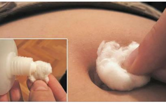 Եթե ՍԱ քսեք ձեր պորտին, կհաջողվի ձեզ հղիանալ