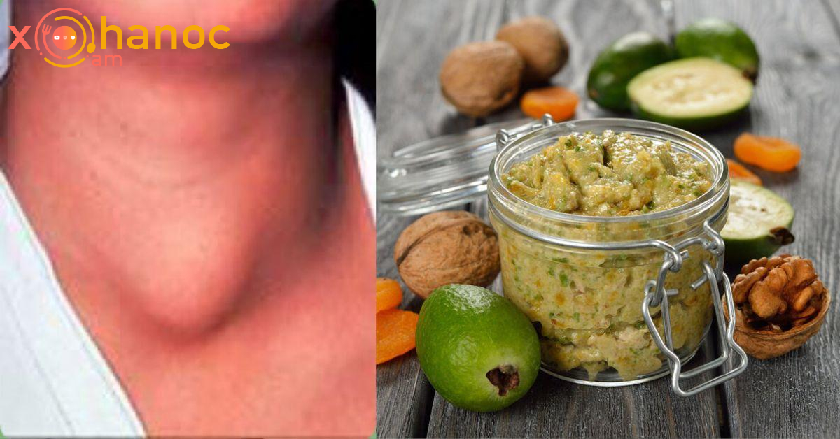 Բաղադրատոմս, որի 2 ճաշի գդալը կբուժի ձեր վահանաձև գեղձը Բաղադրատոմս, որի 2 ճաշի գդալը կբուժի ձեր վահանաձև գեղձը