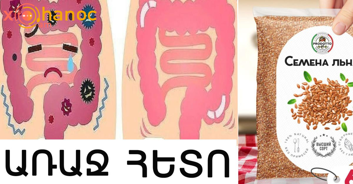 Ինչպես հեռացնել աղիքում կուտակված մինչև 15 կգ տոքսինները