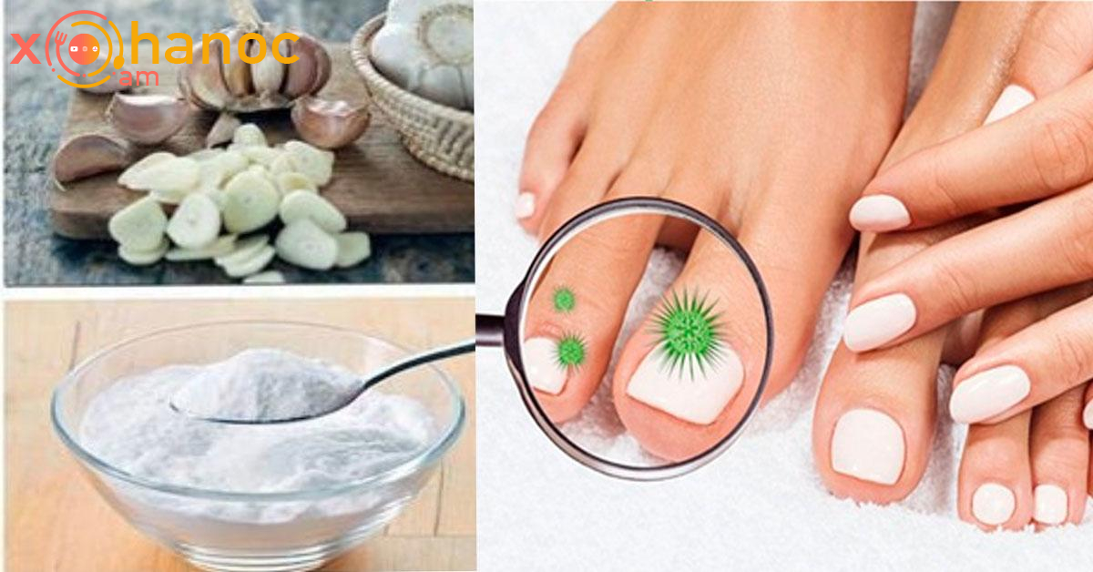 Այս բաղադրիչը կա բոլորի տանը․ Այն վերացնում է եղունգների սունկը և ազատում տհաճ հոտերից