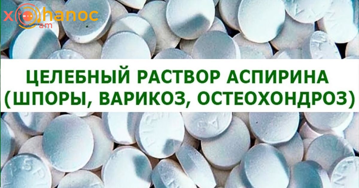 Ասպիրինի բուժիչ լուծույթի միջոցով ազատվեք երակների վարիկոզից և օստեոխոնդրոզից
