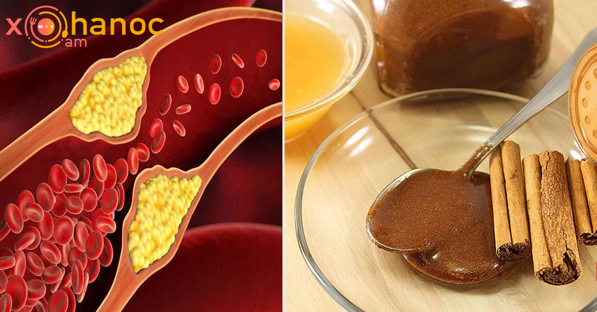 2 բաղադրիչի համադրությունը, որը կանխում է սրտի կաթվածը, նվազեցնում է խոլեստերինը և ամրացնում ձեր իմունային համակարգը