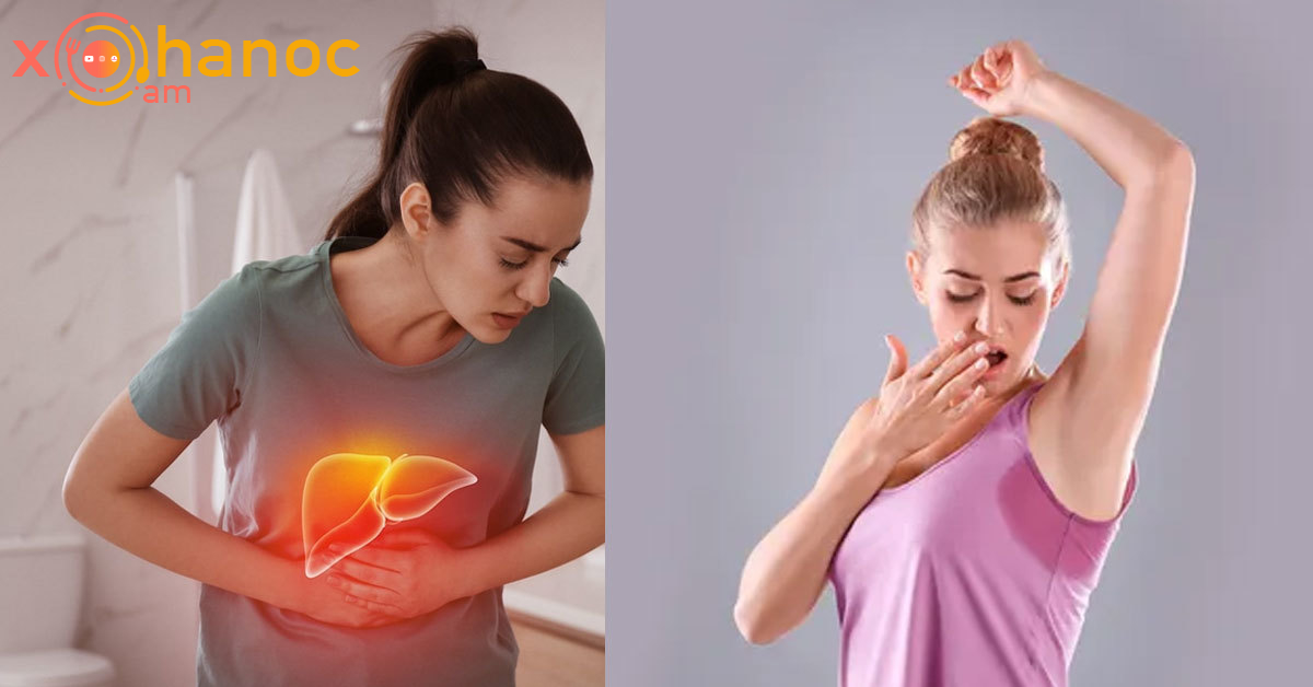 Եթե քրտինքից այսպիսի հոտ է գալիս, դուք ունեք լյարդի լուրջ խնդիրներ
