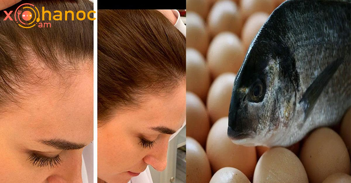 Ինչ ուտել, որպեսզի ձեր մազերը չթափվեն, վերականգնվեն և արագ աճեն. Մթերքների այս ցանկը պահպանեք ձեզ մոտ Ինչ ուտել, որպեսզի ձեր մազերը չթափվեն, վերականգնվեն և արագ աճեն. Մթերքների այս ցանկը պահպանեք ձեզ մոտ