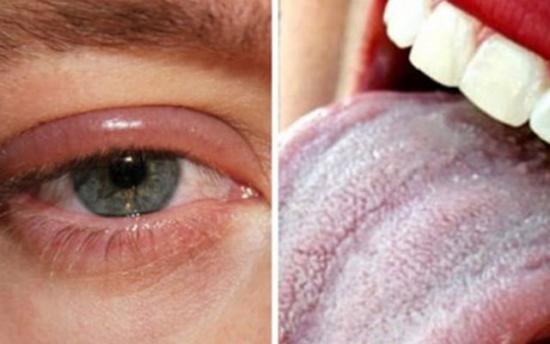 Հիվանդության 15 նշան, որ ուղարկում է մեր օրգանիզմը