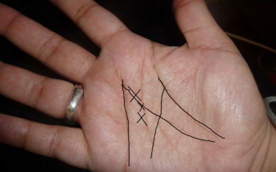 Եթե ձեր ձեռքի ափի մեջ կա M տառը, ուրեմն դուք յուրահատուկ մարդ եք