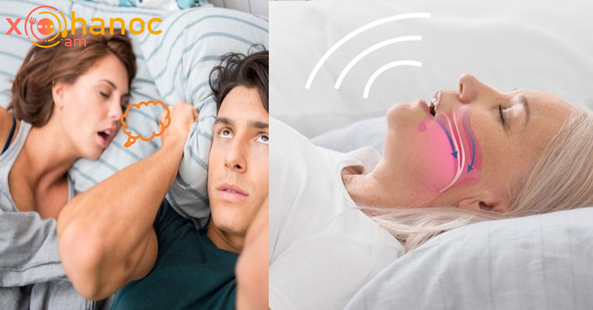 Ինչու՞ է կանանց մոտ խռմփոց առաջանում․ Ինչ լուրջ խնդրի մասին է դա վկայում