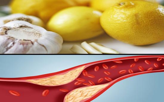 Փորձված բաղադրատոմսեր, որոնք մաքրում են լյարդը, լեղուղիներն ու անոթները