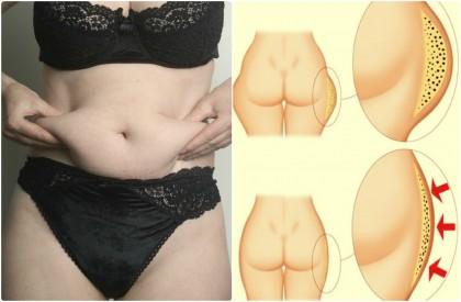 Ազատվեք փորի շրջանի և կոնքերի ճարպերից՝ ընդամենը մեկ բաղադրիչի օգնությամբ (ֆոտո)