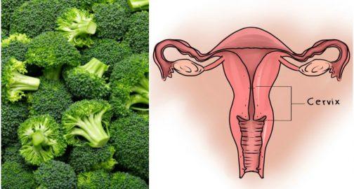 Կանայք պետք է շատ բրոկոլի օգտագործեն. ահա, թե ինչու…