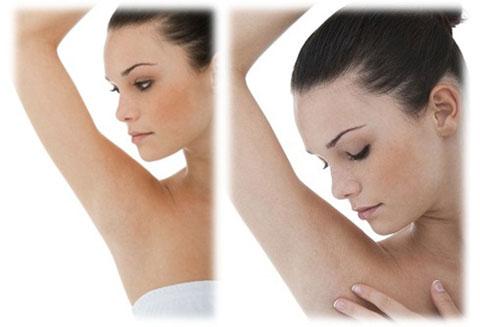 Բաղադրատոմս, որի շնորհիվ կունենաք կատարյալ թևատակեր