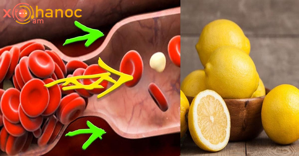 Մթերքներ, որոնք նոսրացնում են արյունը և պաշտպանում վարիկոզից
