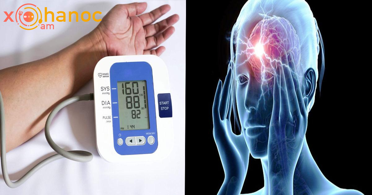 Ինչպե՞ս ազատվել գլխացավից և բարձր ճնշումից